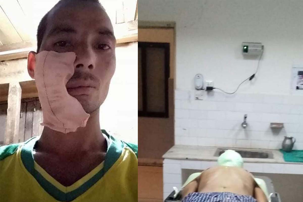 क्यान्सर पिडित सुरेशको उपचारका लागि सहयोग जुट्दै 